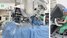 SNUH 成功完成单孔机器人肾脏移植 