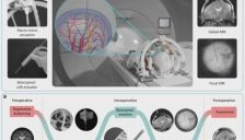 国家专项新突破！中国团队自主研发核磁兼容手术机器人，实现亚毫米级精度！ 