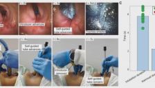 被Nature亮点报道，登Science子刊！机器人插管急救新技术！ 