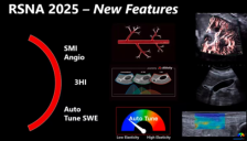佳能超声AI技术获FDA批准 驱动影像升级 