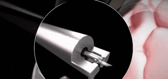 马斯克脑机接口获突破 万人排队接受植入手术 