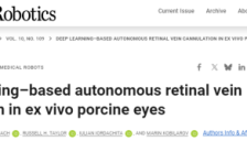 顶刊发布！失明患者迎来新希望 机器人视网膜静脉插管系统问世 