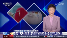 中国脑机接口技术取得重大突破，截瘫患者用意念打游戏并操控小米家电 