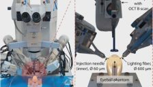 中国团队研发眼科自主手术机器人注射成功率达100% 