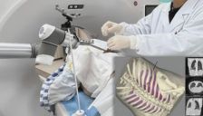 珠海首例机器人穿刺手术成功，AI主刀5分钟完成肺结节切除 