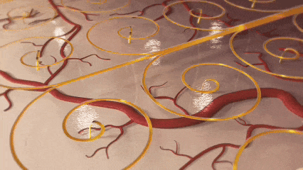 中国团队突破脑机接口技术瓶颈 