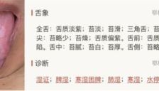 AI中医诊断软件看舌头APP的结果与数据如何解读 